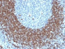 CD79B Antibody (IGB/1842) - Azide and BSA Free, Novus Biologicals 100 &mu;g | Buy Online | Novus Biologicals | Fisher Scientific